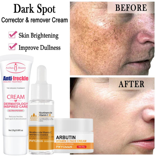 Whitening Anti Freckle Cream Effective Remove Melasma Serum Fade Dark Spots Melanin Moisturize Brighten Smooth Face Skin  Care