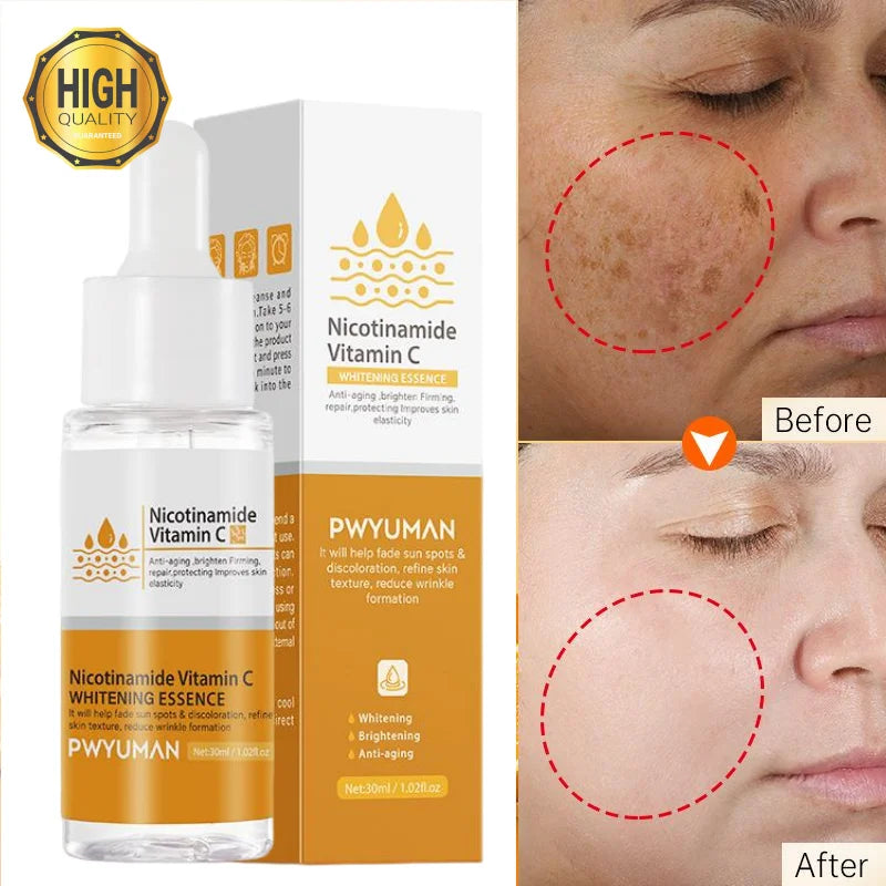 Whitening Anti Freckle Cream Effective Remove Melasma Serum Fade Dark Spots Melanin Moisturize Brighten Smooth Face Skin  Care